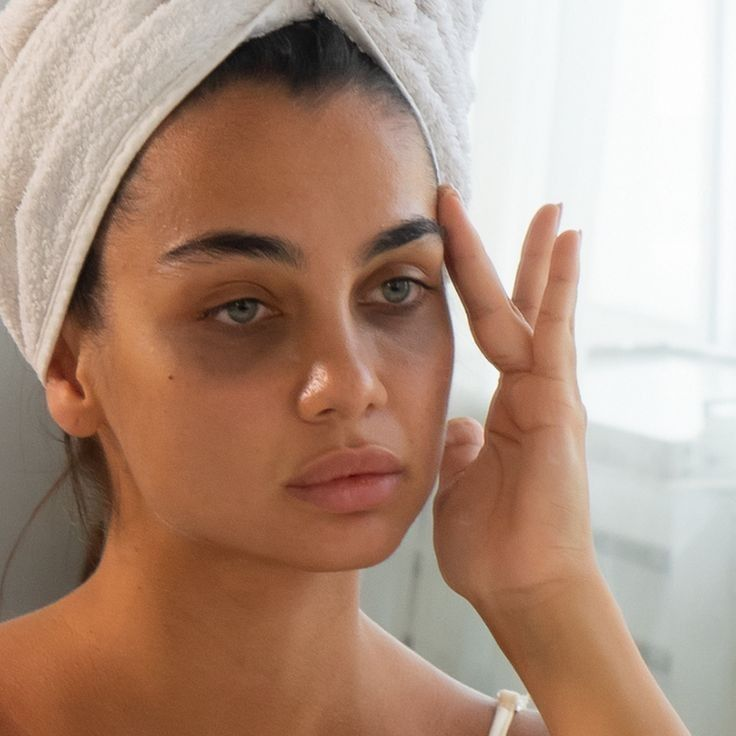 Under Eye Pigmentation Hollow