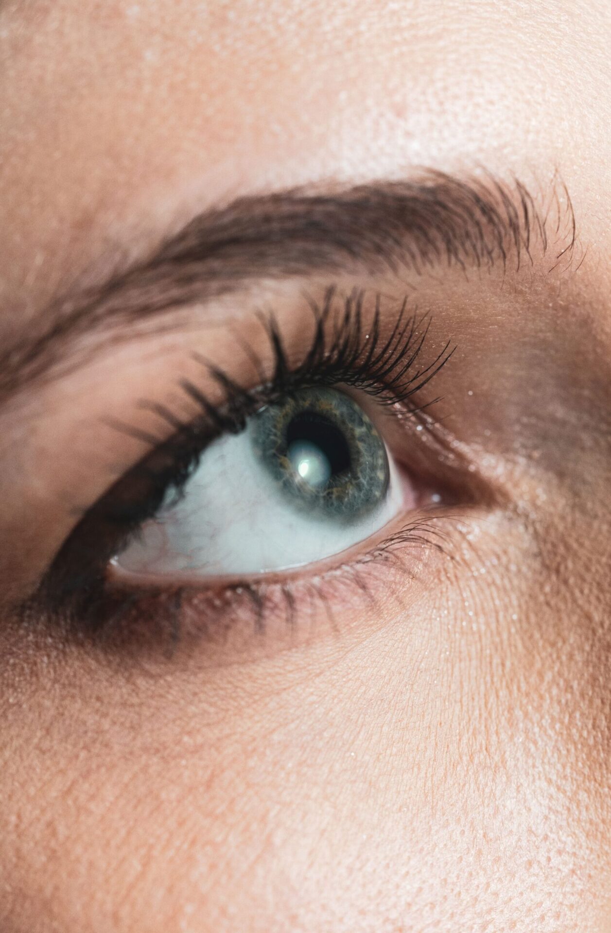 Under-eye filler educational visual showing the lower eyelid and cheek area