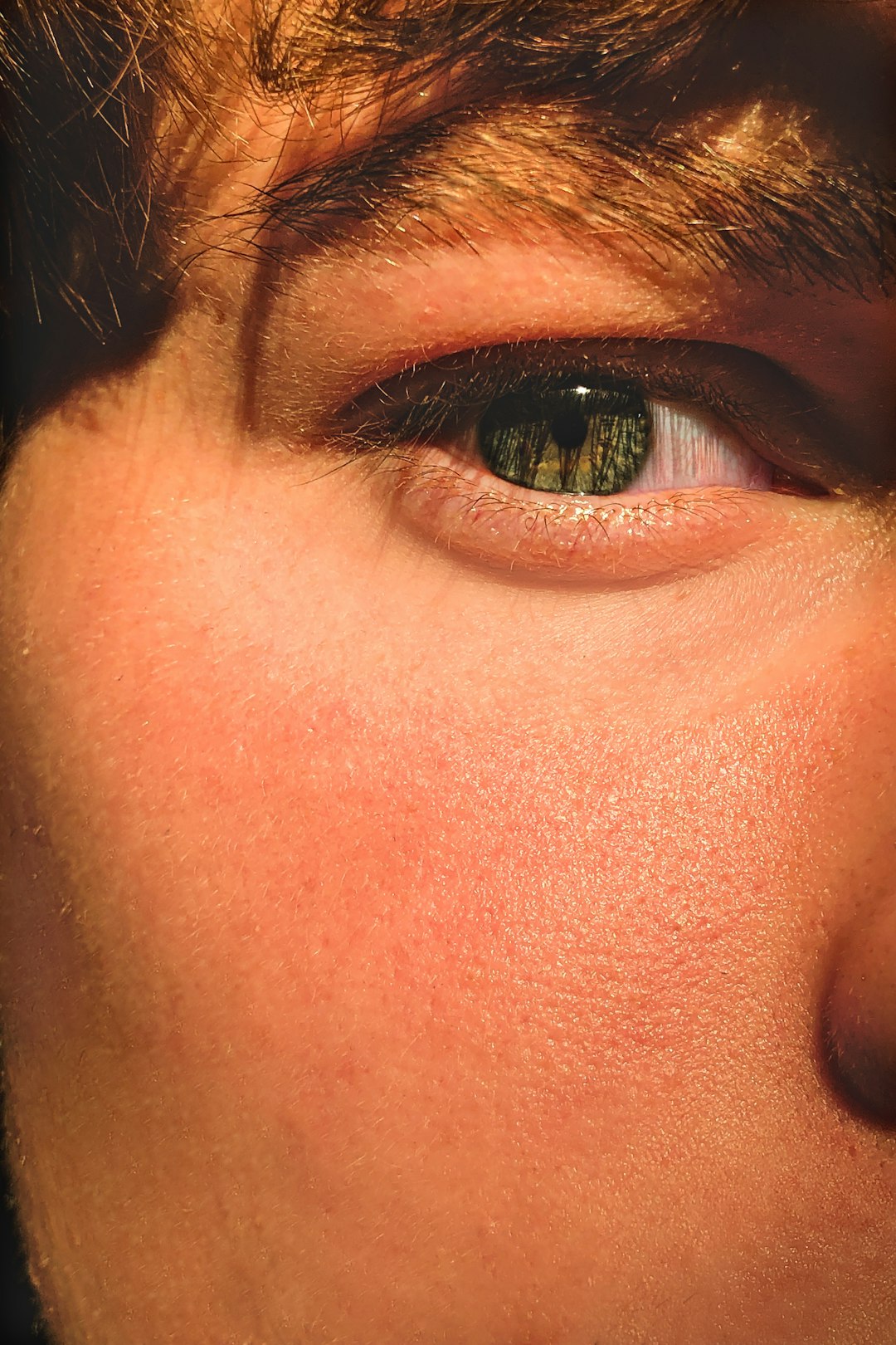 Close-up eye portrait for under-eye anatomy context