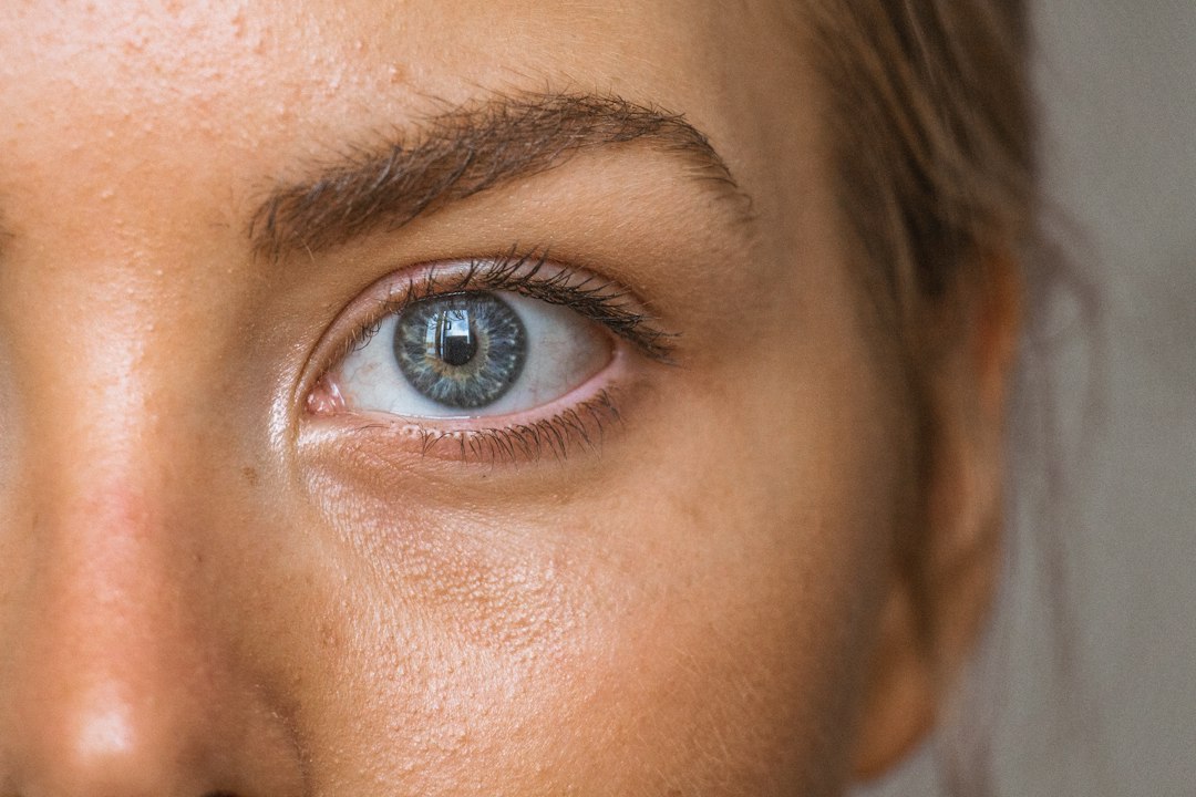 Close-up eye and under-eye area in natural light for educational context